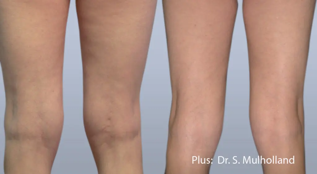 Wrinkle Treatments Before and After Pictures Brentwood, TN